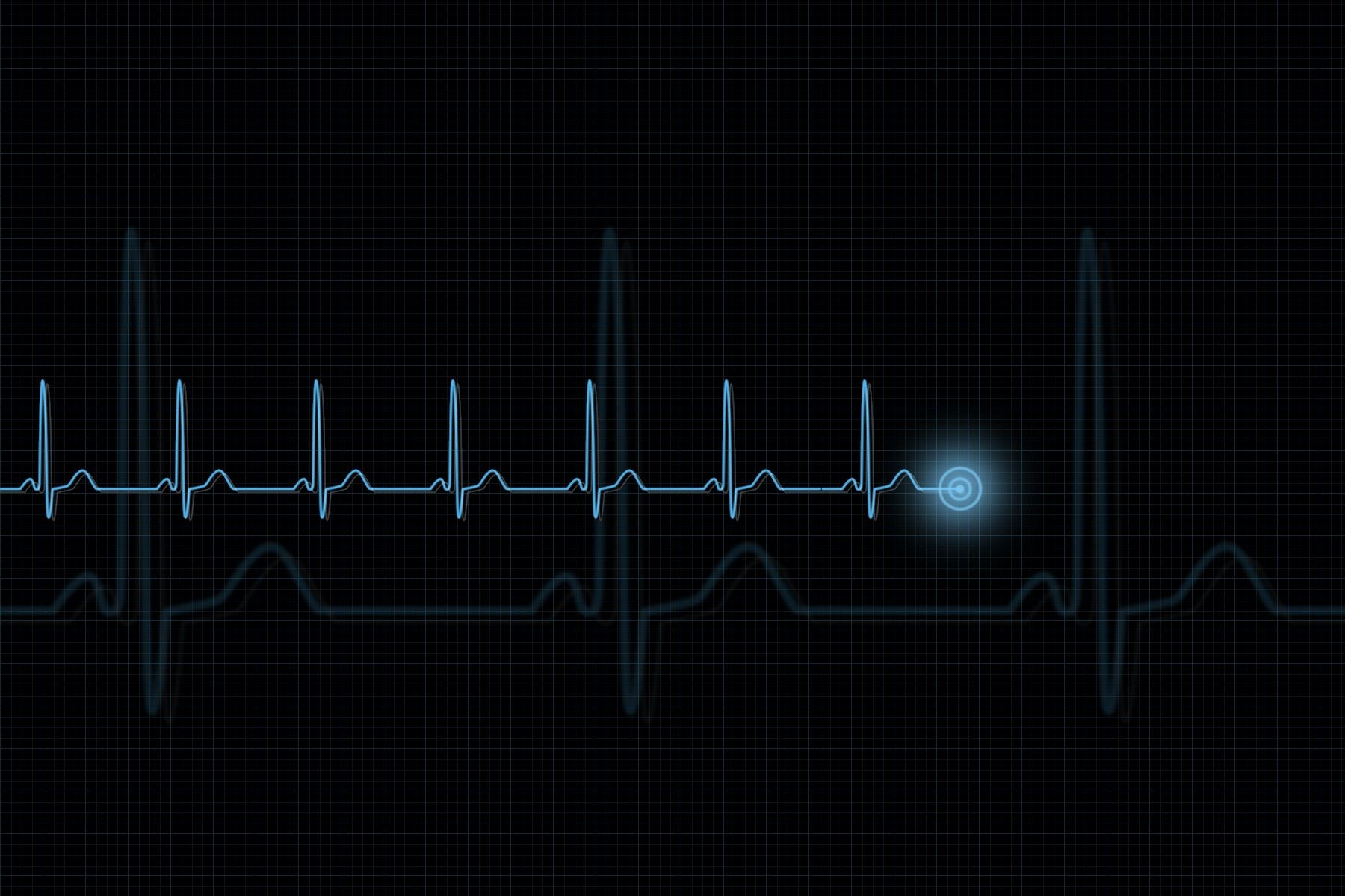 Pulse Trace